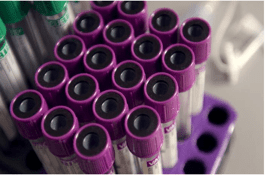 test tubes