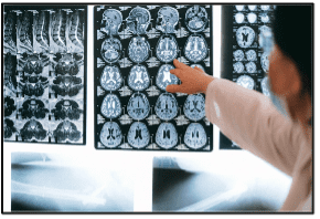 MRI scans