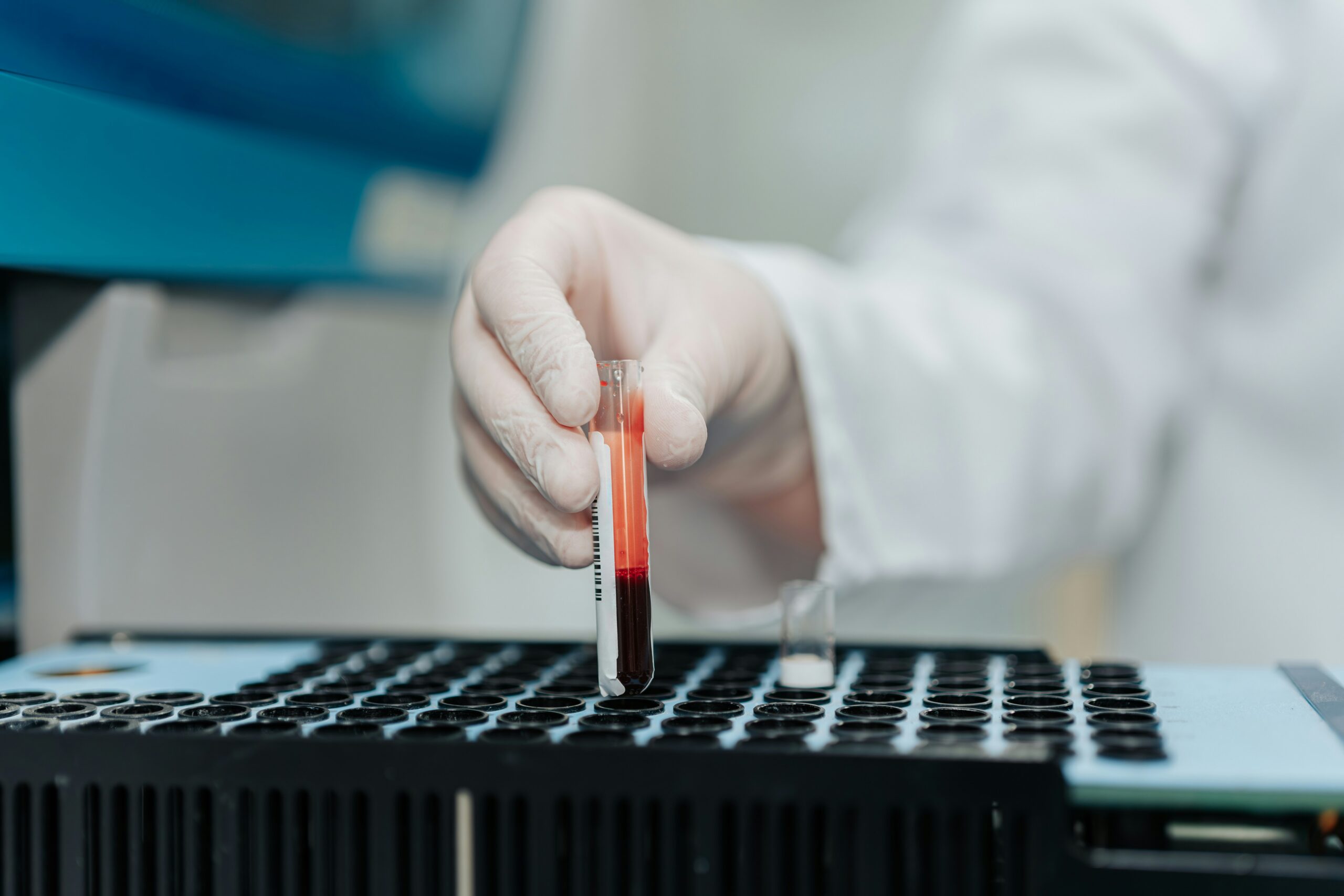 Close up of lab technician pulling a vial of blood from a storage unit.