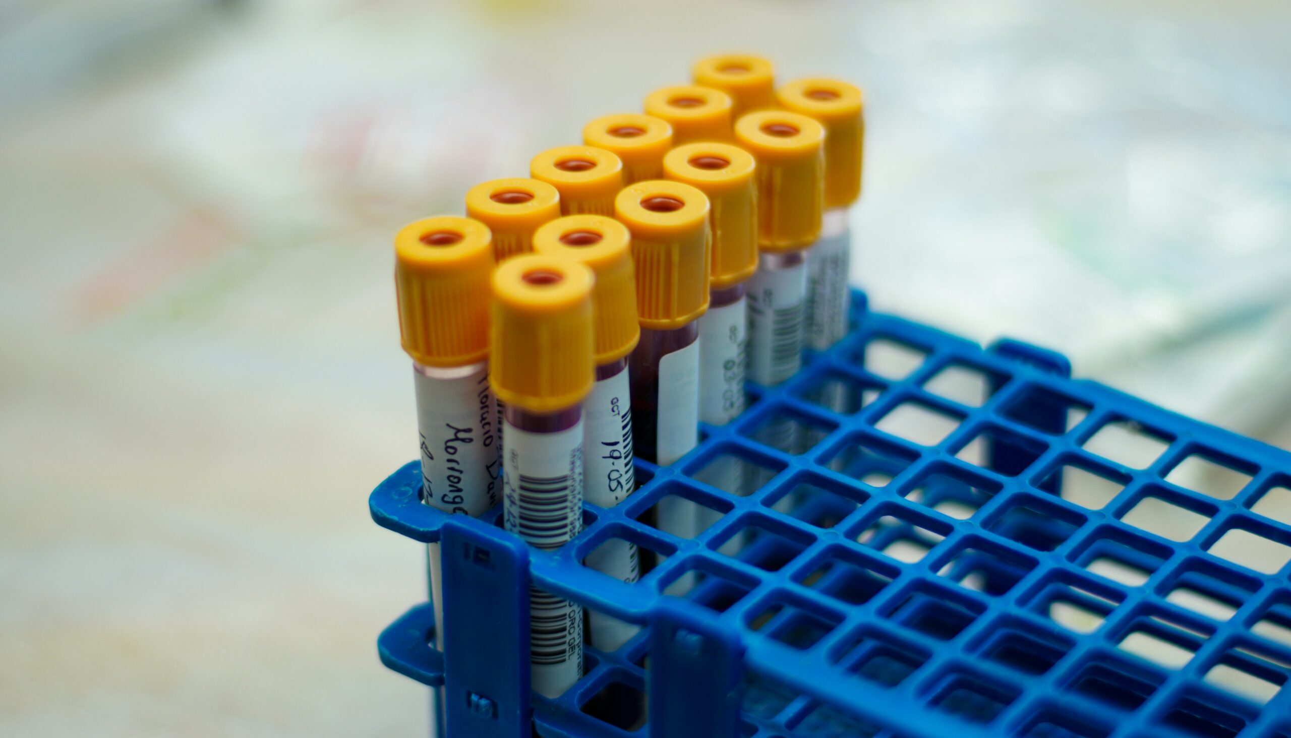 rack of blood samples in vials
